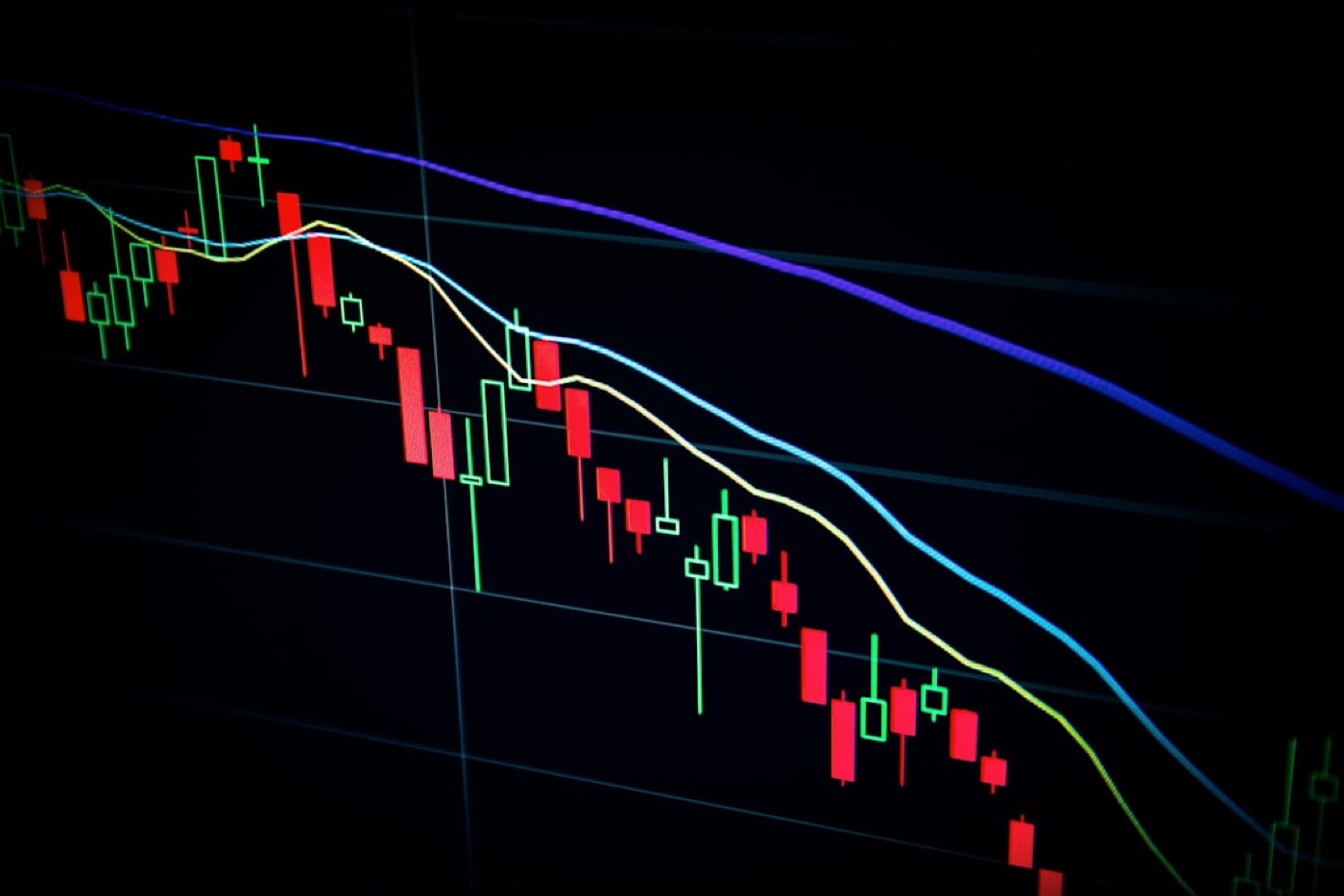 Options trading screen — the accidental straddle experiment that started the Oyamori thesis